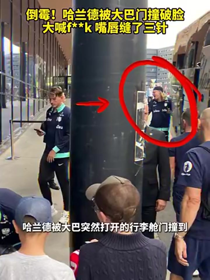 嘴角缝了三针！哈兰德被大巴车门撞破脸，现场大喊：Fk
