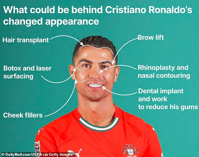 整形医生分析：C罗面部可能进行过多次整形手术