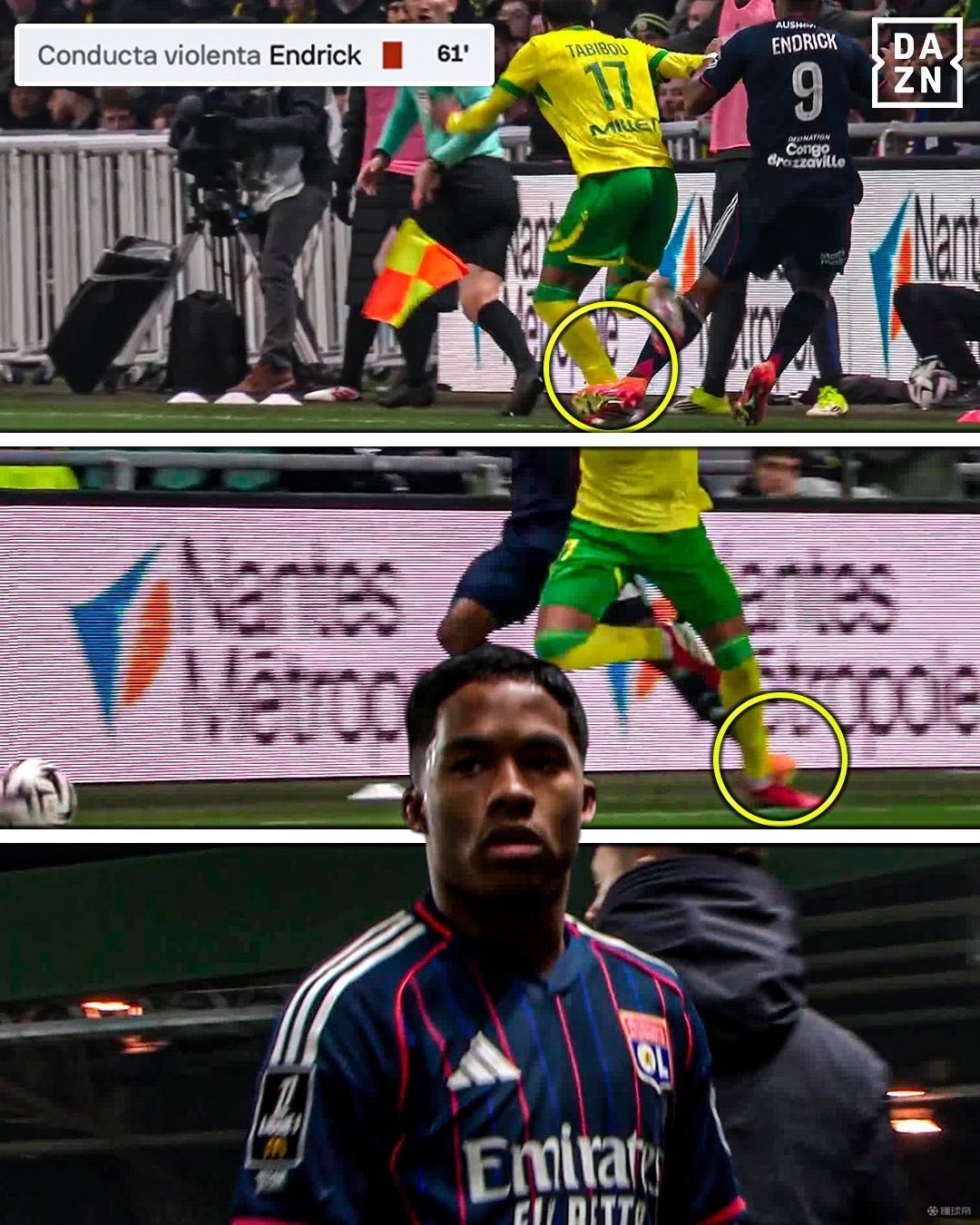 恩德里克拼抢中蹬踏对方球员，被直接红牌罚下