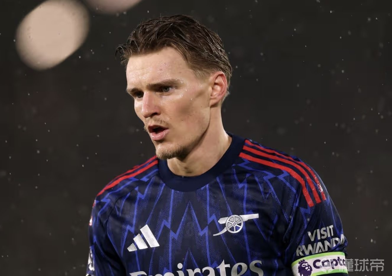 厄德高谈伤势：膝盖非常疼，但目前伤势不算太重