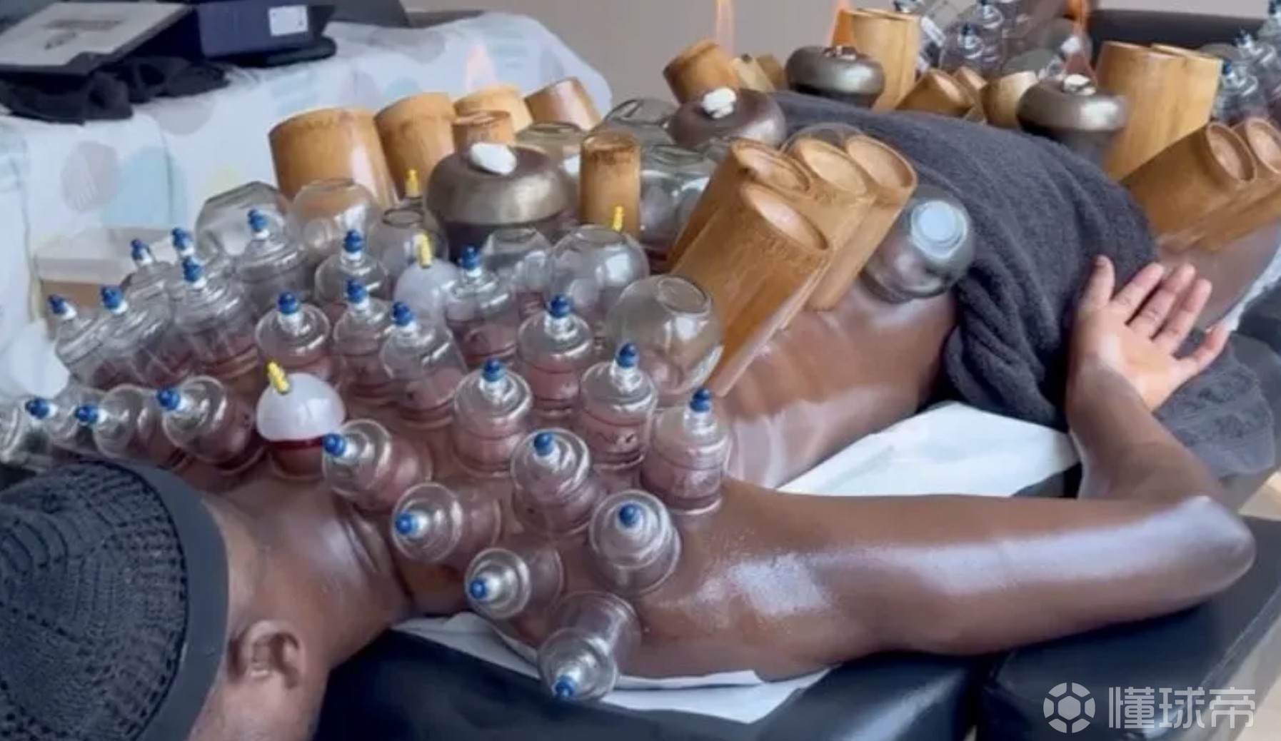 挺管用，吉拉西接受拔罐治疗后在对阵美因茨时梅开二度