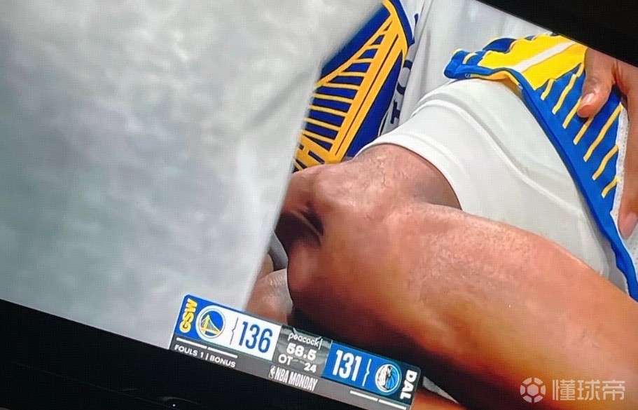 恐怖时刻！穆迪遭重伤膝盖骨错位突出明显，转播信号随即切断