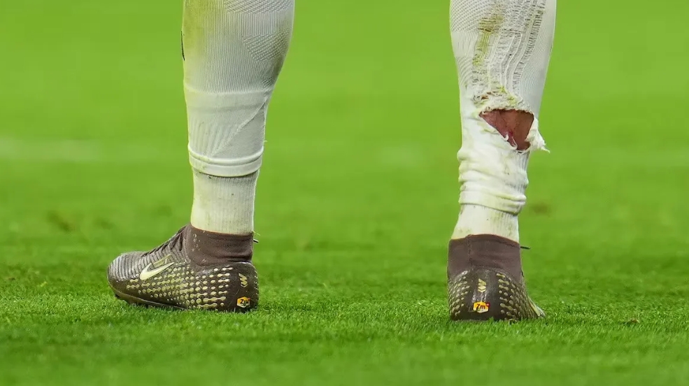 球袜被直接踢破！姆巴佩遭拜仁后卫塔犯规后 血痕清晰可见