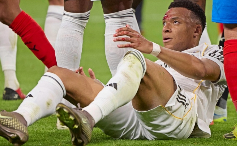 争议！姆巴佩禁区内脸部遭肘击后眼角流血 裁判未判点