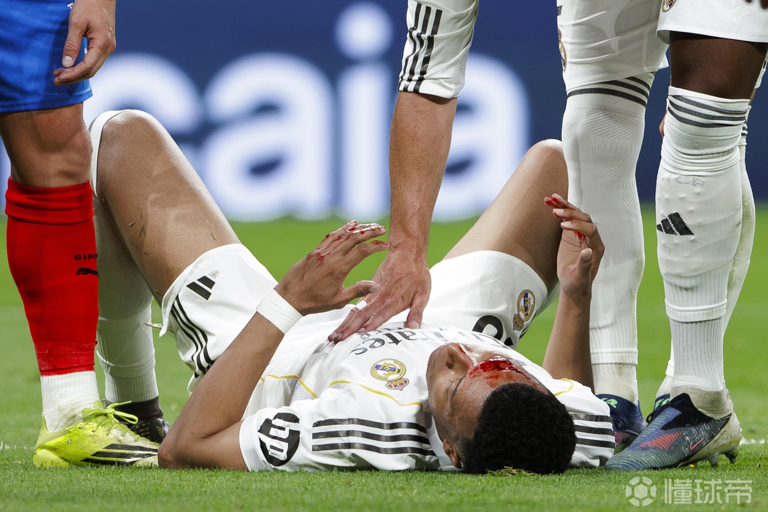 裁判分析机构：姆巴佩被肘击是明显点球，VAR不介入匪夷所思