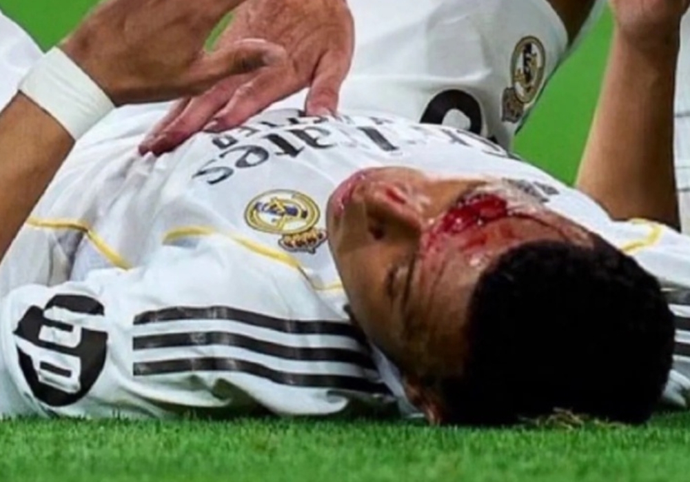 皇马官方：姆巴佩眉骨缝针 缺席球队今日合练