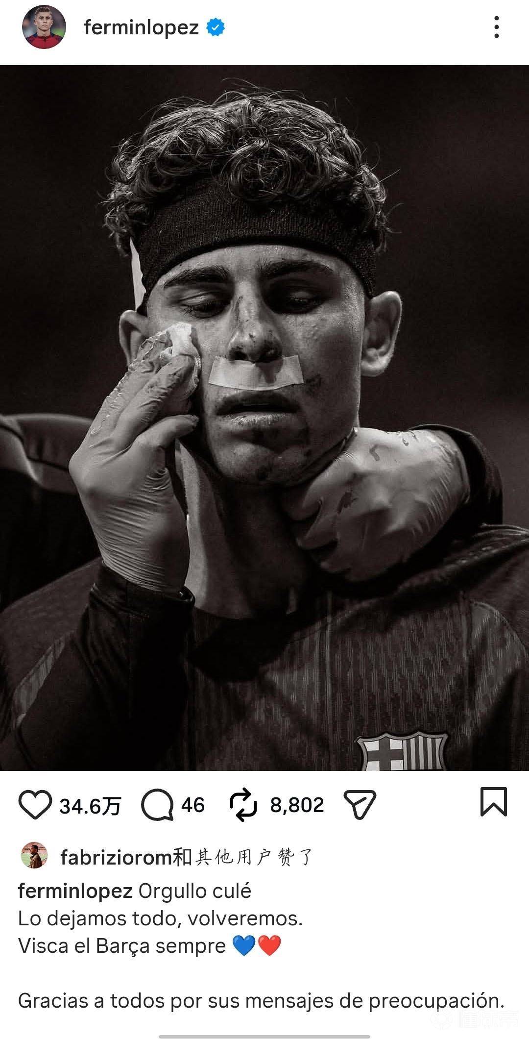 费尔明社媒晒脸部受伤照：我们付出了一切，我们会再回来的