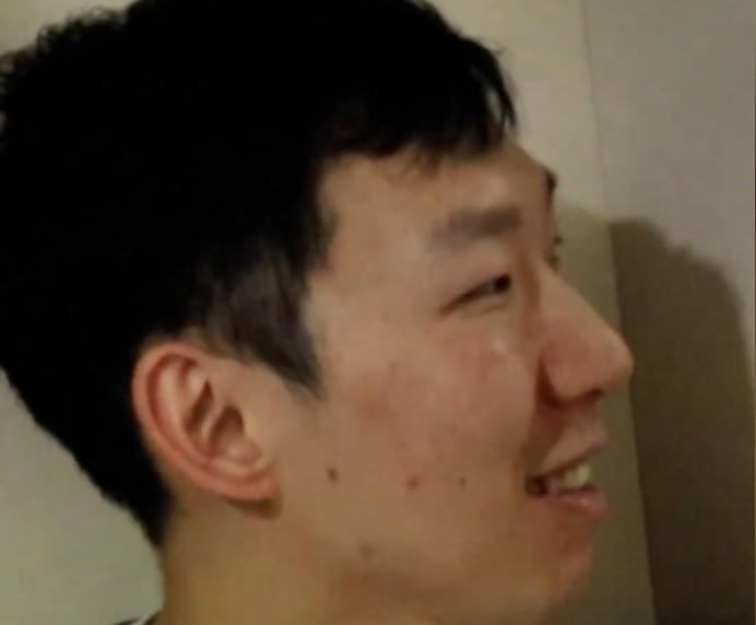 周琦：牙被打掉了一小块；我们是一个很团结的球队